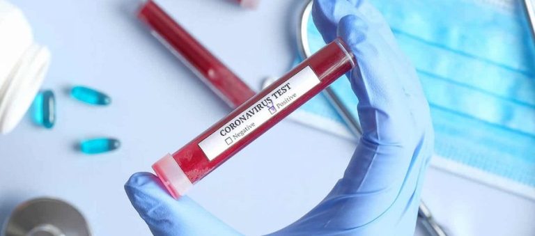 Covid-19: projeto propõe testes em massa na população a custo baixo em Santa Catarina